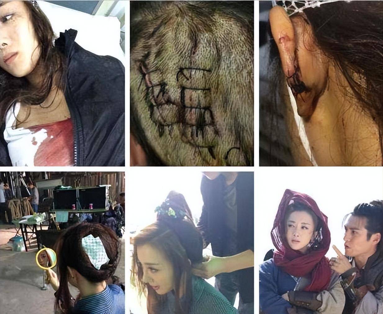 "纵狗"咬伤李依晓,呛声金星生不了孩子,叶璇到底有多奇葩?