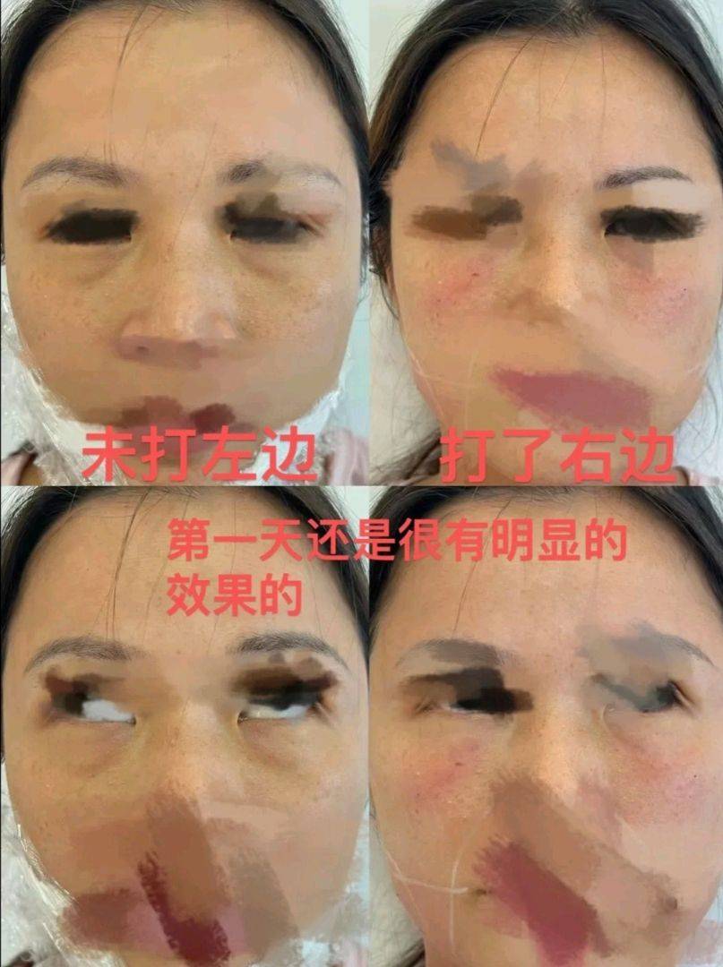 屡遭消费者指控效果差 南昌佳美美容医院问题出在哪儿了?(图3)