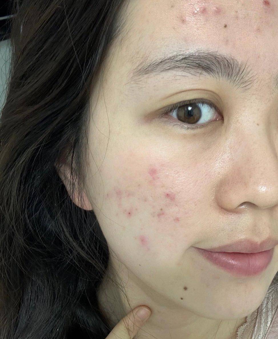 怀孕变丑了是怎么回事？医生说出原因