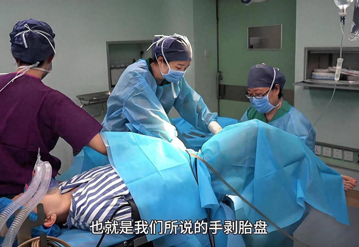 手剥胎盘为什么说大家都闻风丧胆呢？这个实操就告诉我们