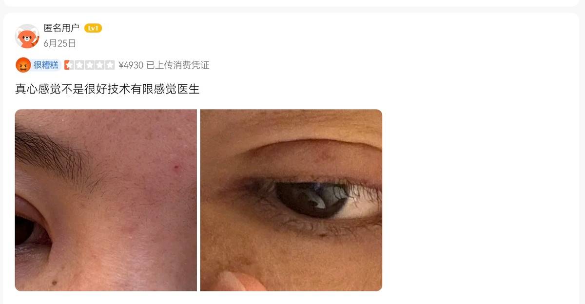 厦门欧菲医美深陷“套路贷”投诉泥潭:百条差评爆雷无效果(图6)