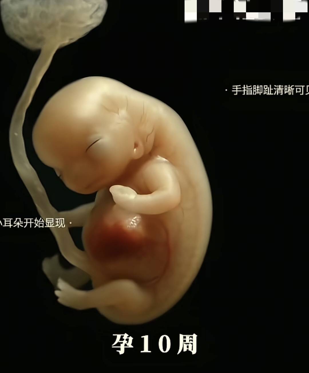 从胚胎到变成胎儿这个孕早期的过程到底是怎么样的？