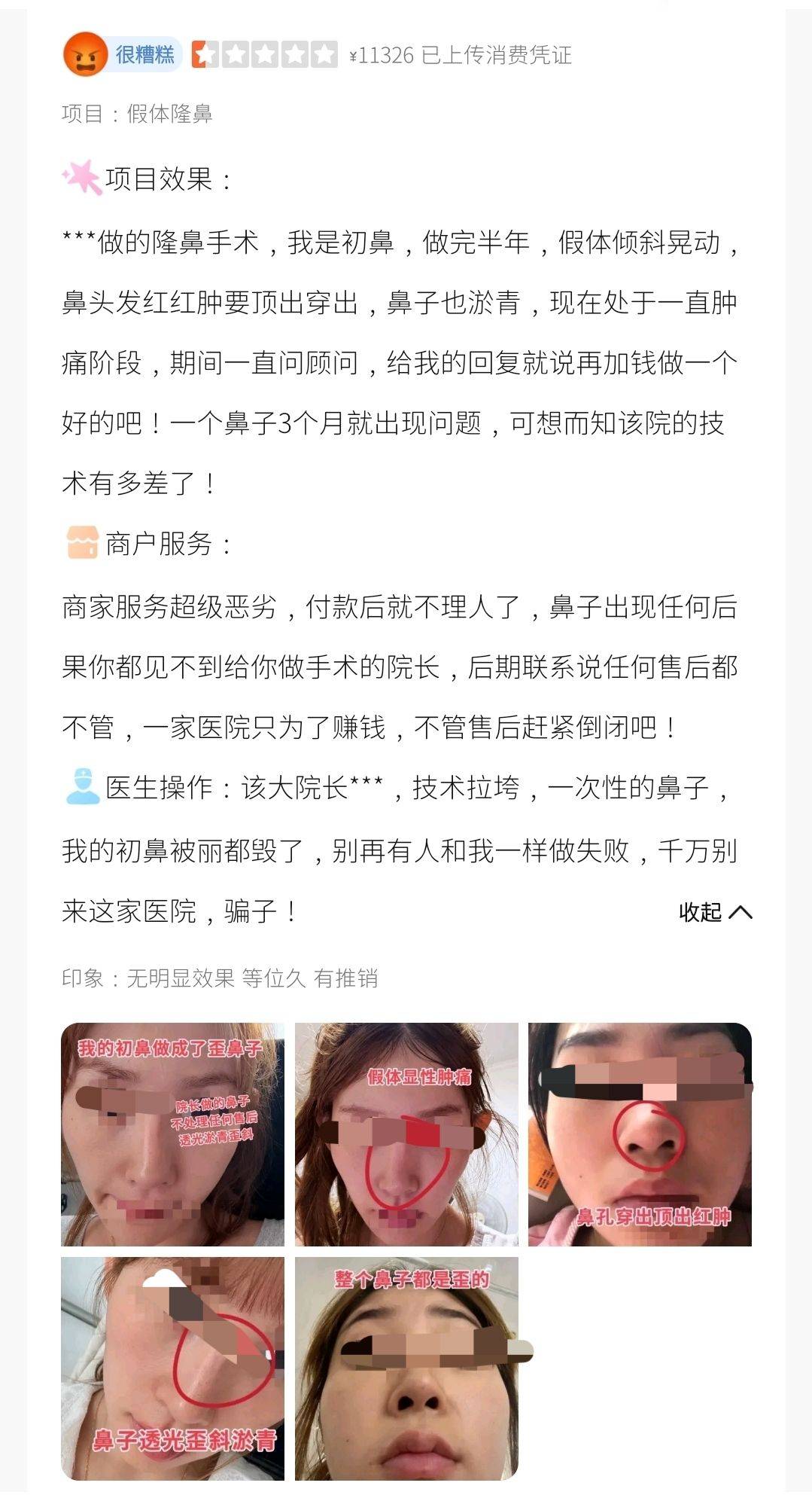 太原丽都整形被曝当面拆封:转身减量 求美者直呼被当傻子(图19)