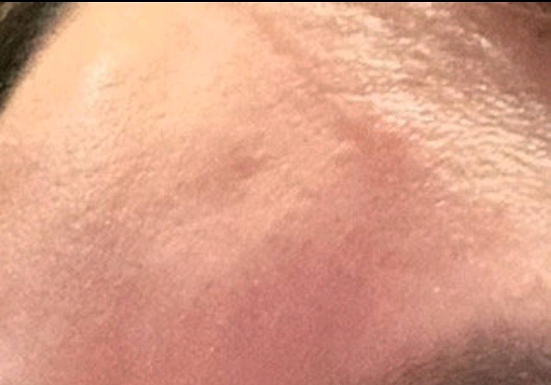 太原丽都整形被曝当面拆封:转身减量 求美者直呼被当傻子(图6)