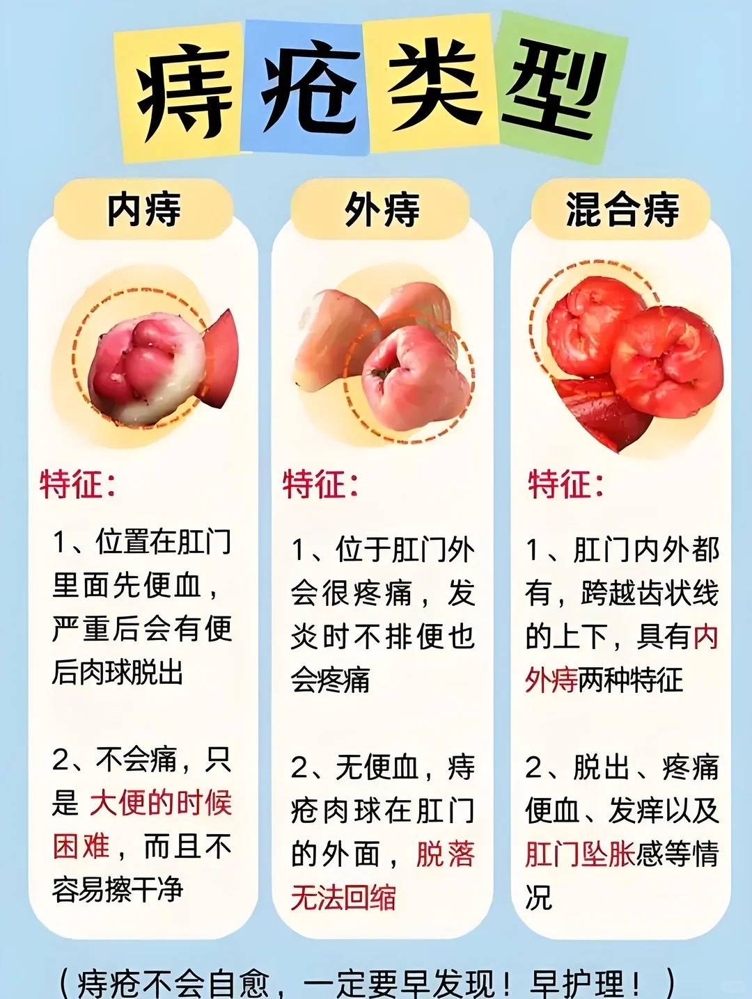 人为什么会得痔疮