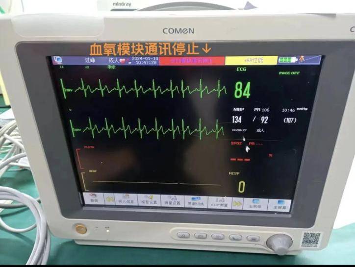 选对血氧仪先搞懂这4种类型再说！亲测町石tinx指夹式脉搏血氧仪