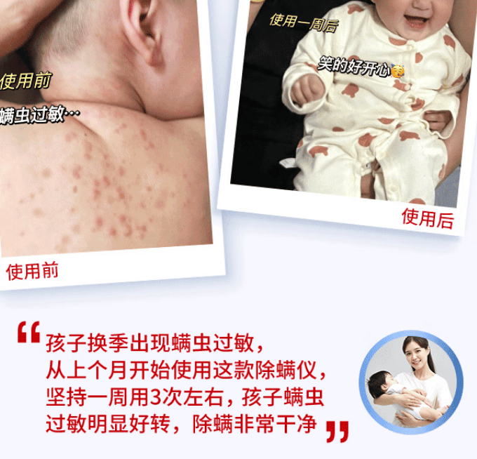 除螨仪买什么牌子好？良心推荐除螨仪排行榜10强品牌！断层爆款