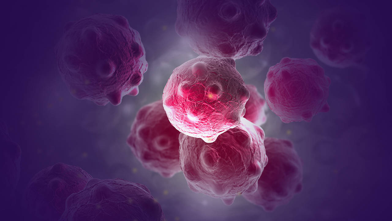 检查出多处转移，食管癌患者该如何选择治疗方向?