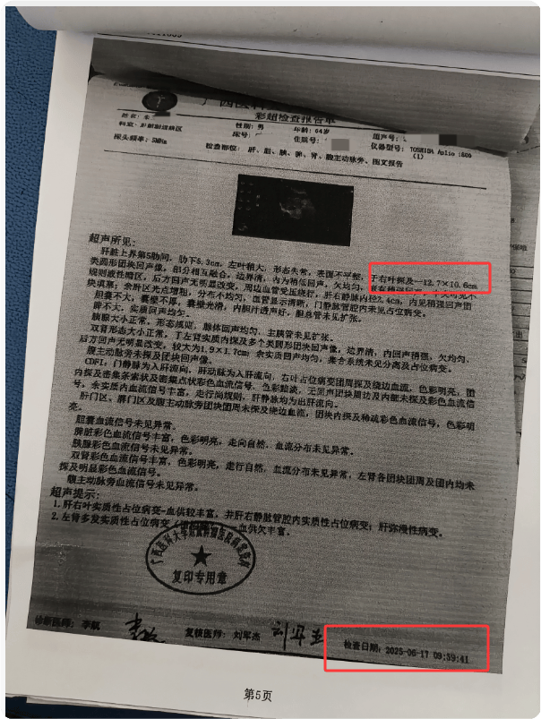 肝癌确诊后，朋友疏远、家人计较，陷入低谷时出路在哪?