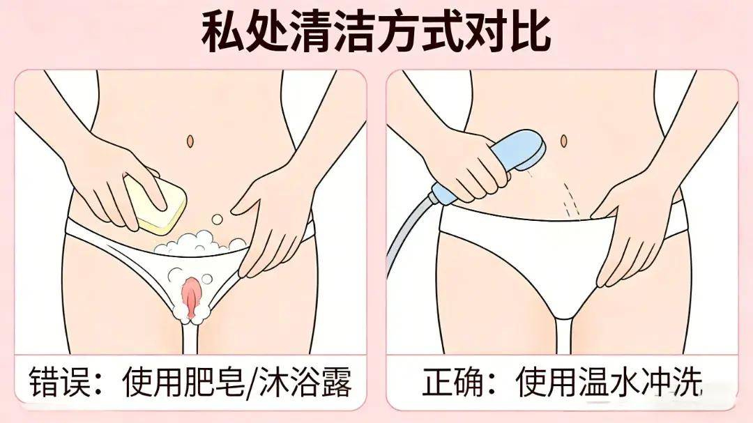 私处反复瘙痒、干涩,多半是这4个习惯惹的祸