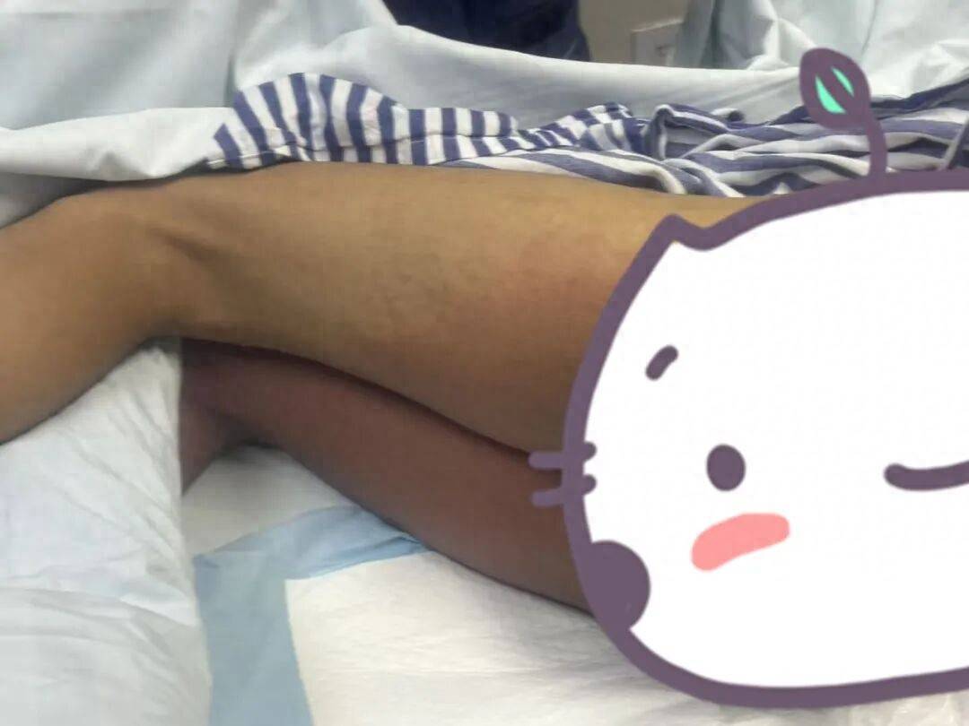 这种液体溅到裤子上，几小时后福建男孩被下病危通知，送进ICU！医生紧急提醒