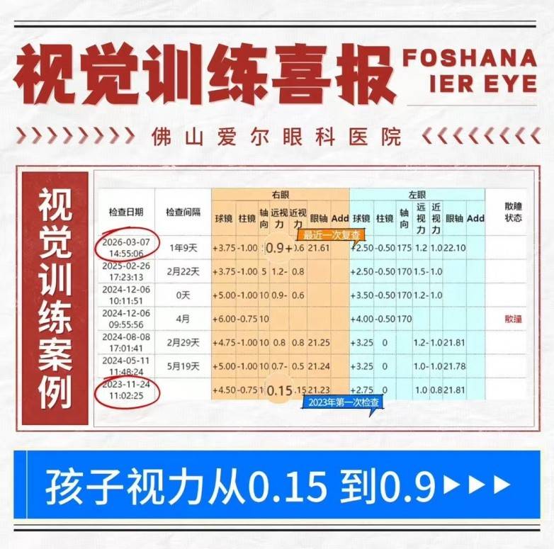 佛山爱尔李亮亮博士:用个性化视觉训练,帮孩子“懒惰右眼”从0.15提至0.9+(图1) 佛山爱尔李亮亮博士:用个性化视觉训练,帮孩子“懒惰右眼”从0.15提至0.9+(图1)