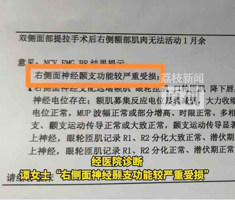 从双眼皮毁容到盗用肖像 上海颜净医美的瓜怎么越吃越多?(图11) 文章配图-1