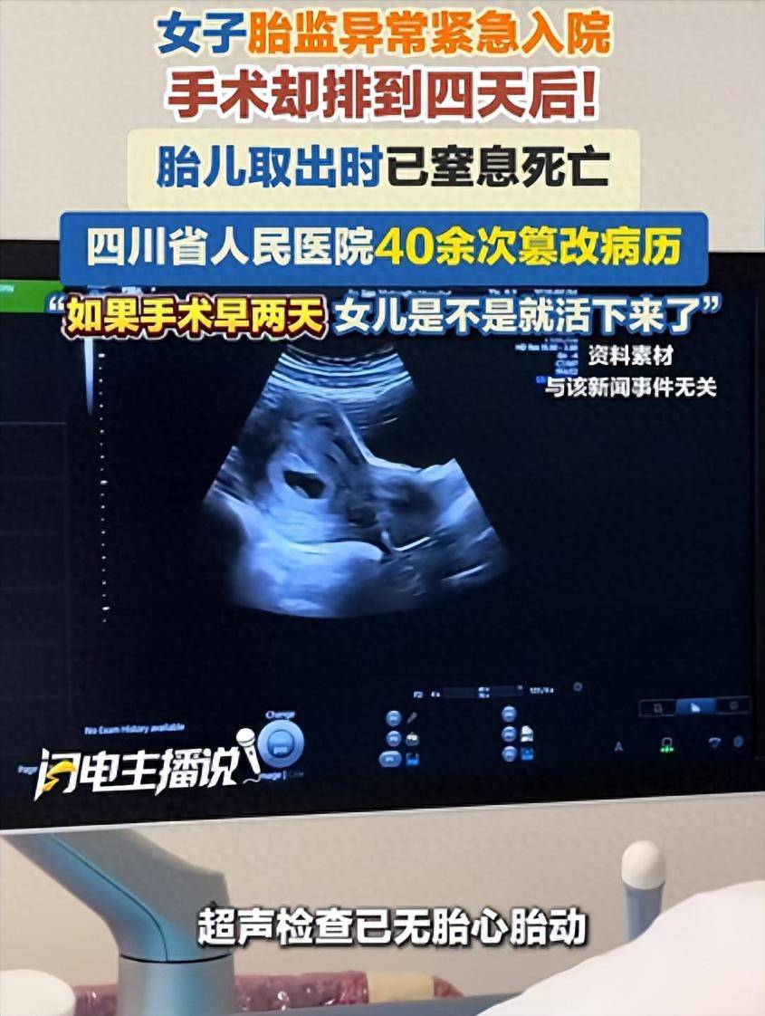 孕妇胎监异常入院遭拖延致胎死 医院40余次篡改病历被判全责(图1) 文章配图-1