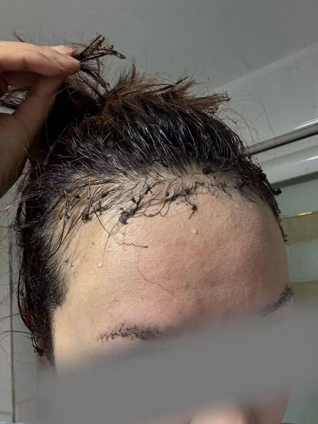 女子用定妆喷雾后点火突发火球扑脸