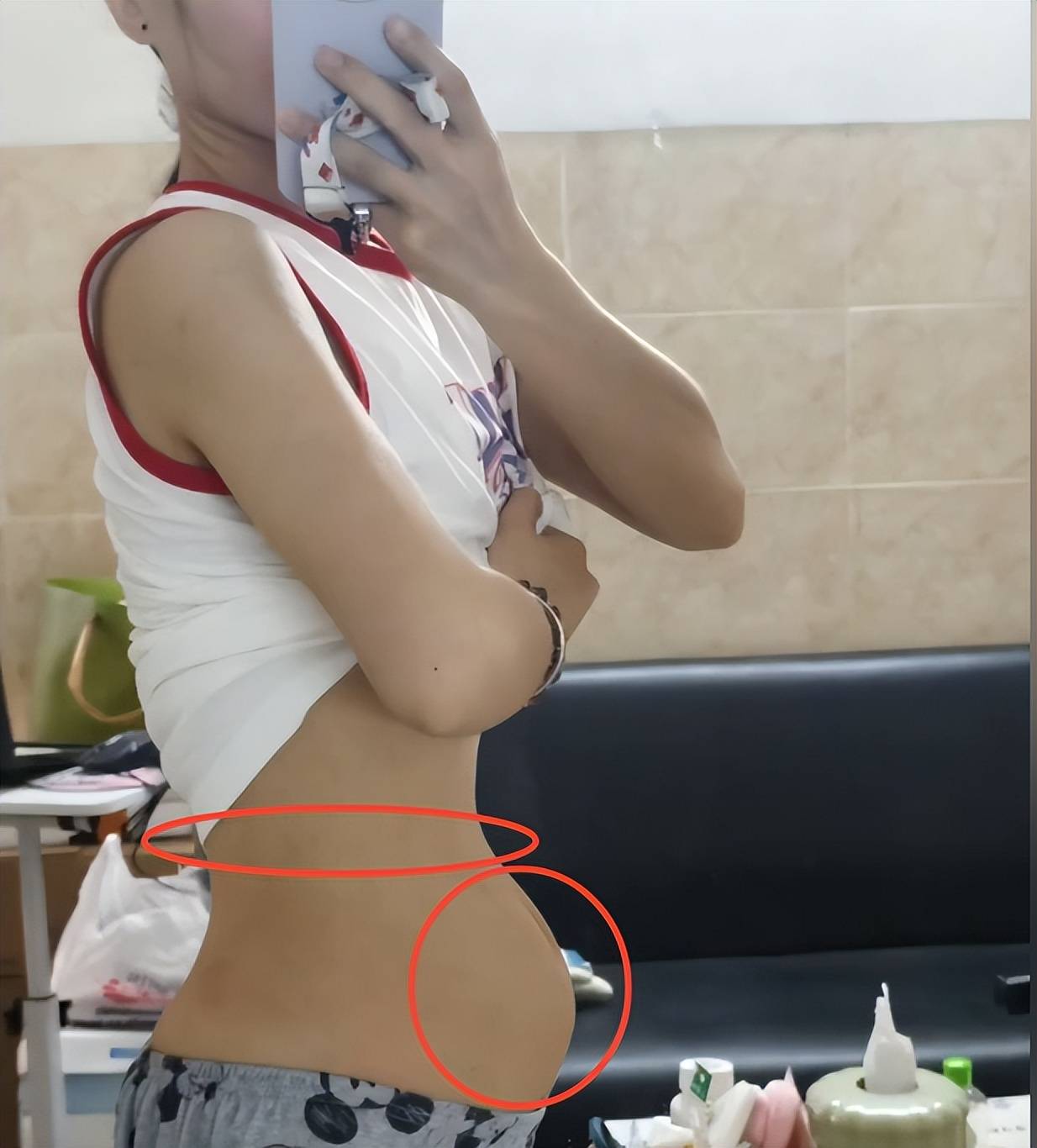 孕38周胎儿正常,孕妈纤细的腰,肚子像吃火锅后凸起！做好8点你也可以长胎不长