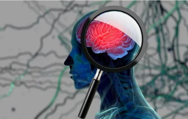 症状_神经系统_影响