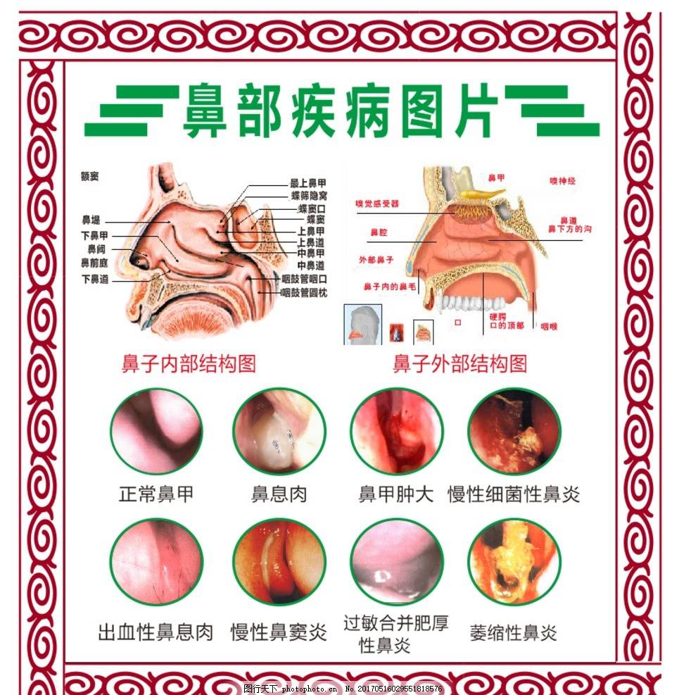 鼻郎中多久有效果(使用鼻郎中的效果持续时间)