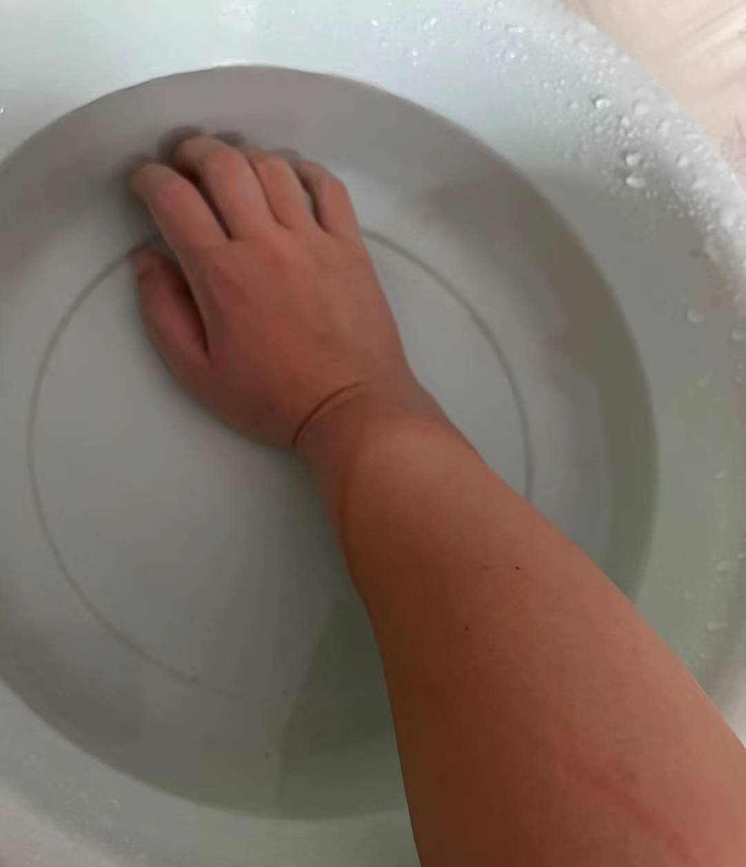 最强腱鞘炎祛除攻略来袭!这篇文章教你轻松应对!