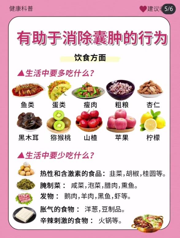 预防及解决囊肿一般常见于20-50岁的女性,尤其在育龄期和绝经期要特别