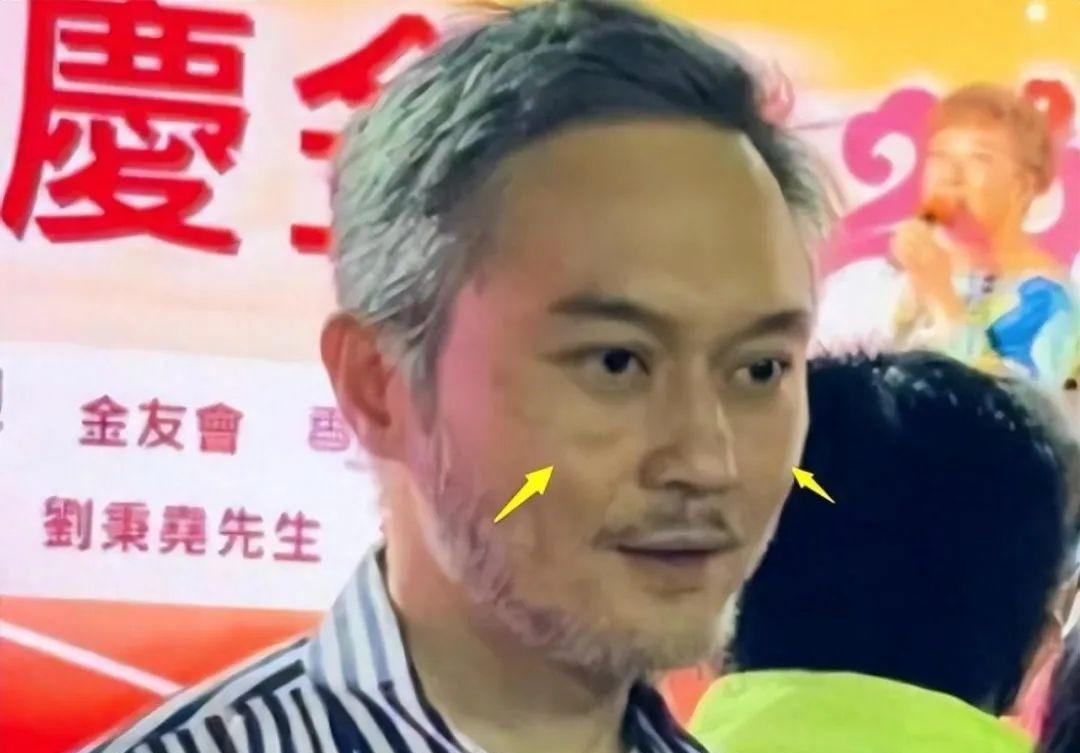 但如果要说被白发影响颜值最大的还是张智霖,张智霖一直是港圈公认的