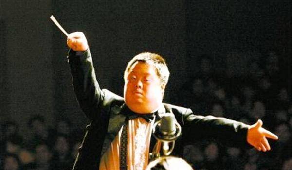 唐氏综合症可不是普通的疾病,知道的人都知道,患上这种病的人这辈子