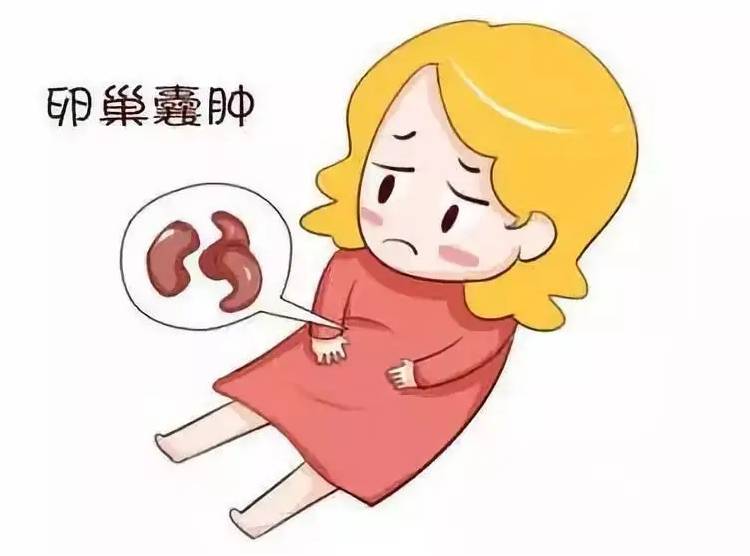 卵巢囊肿有几种类型(卵巢囊肿影响怀孕吗)