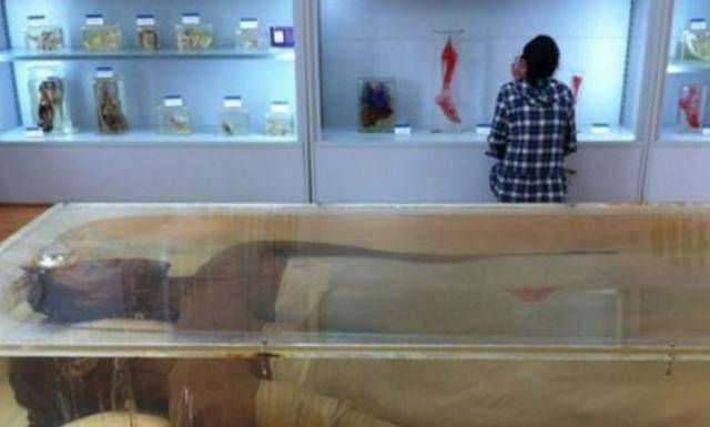 原创湖南女巨人曾金莲14岁比姚明高18岁离世主动捐赠遗体