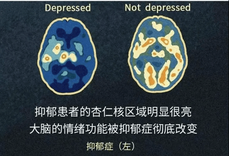 心理障碍病理图片