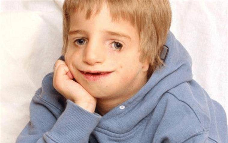 里昂先天脸部畸形,凭才华娶漂亮娇妻,孩子出生后,全家失去笑容