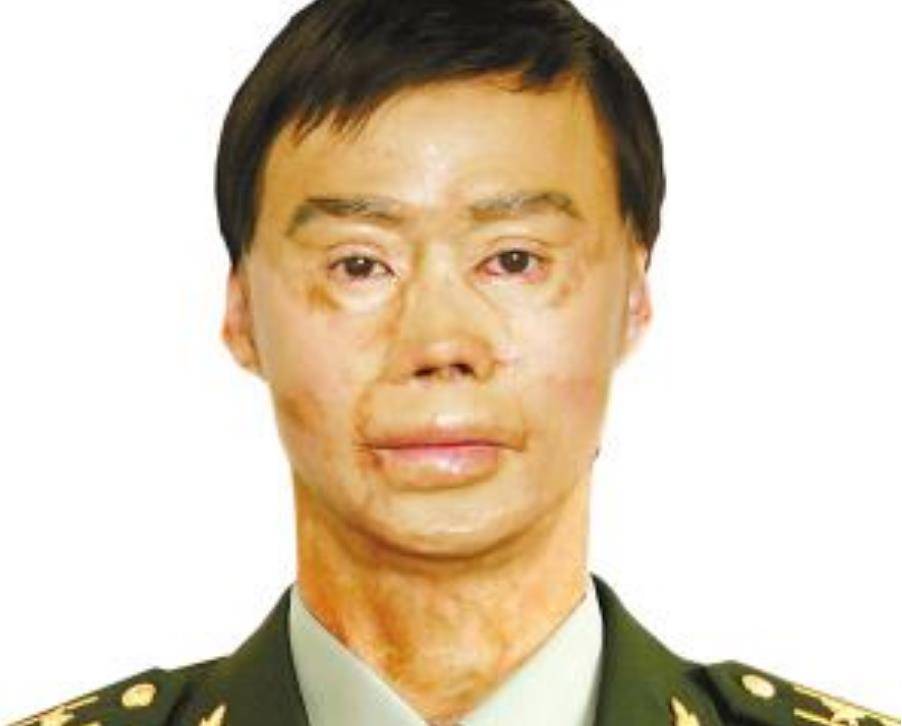 1995年,兵哥哥梁强为救27名乘客重度烧伤,女友始终不离不弃