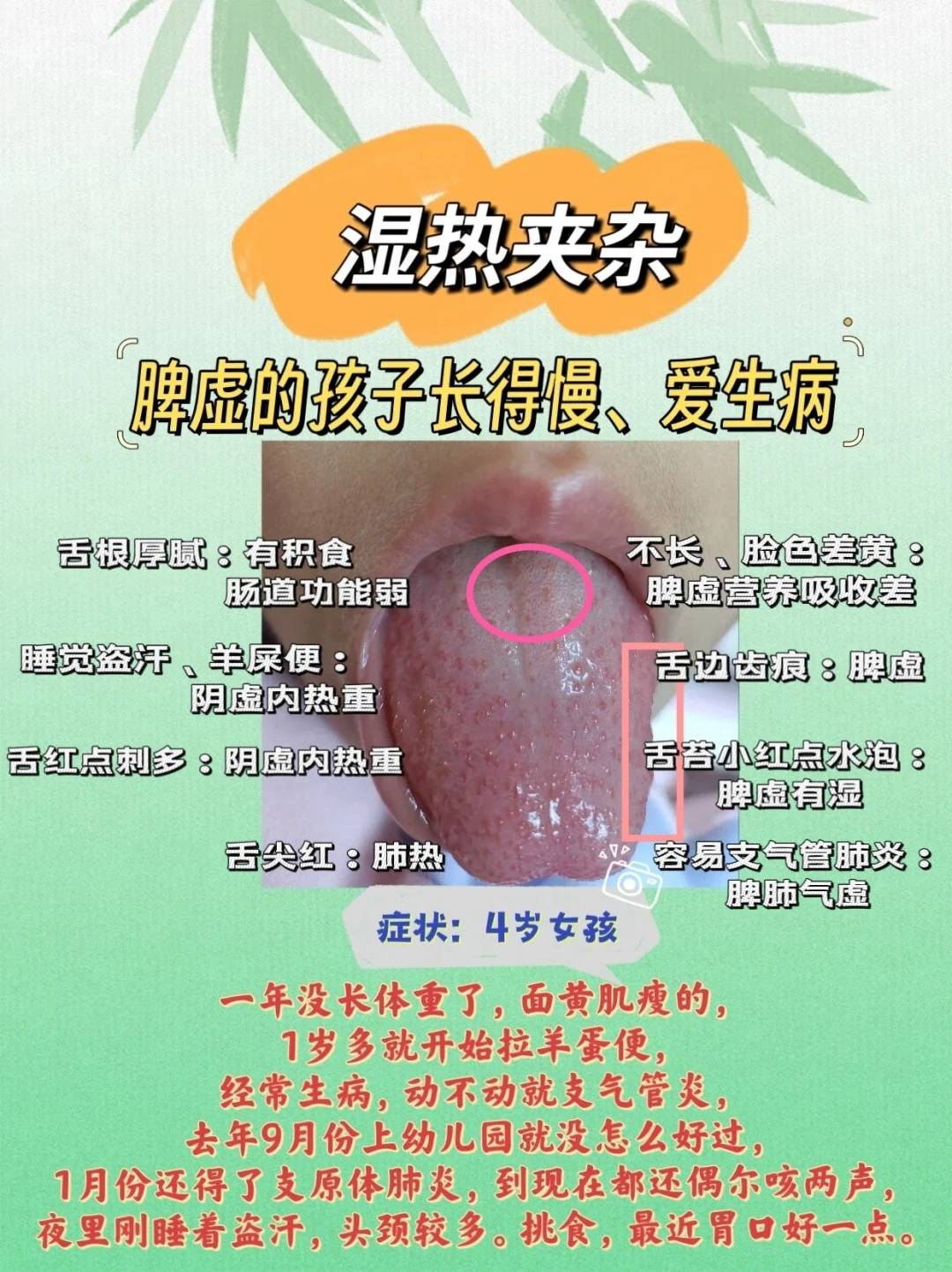 症状分析:991,孩子不长肉不长个:脾虚营养吸收差992,经常生病支