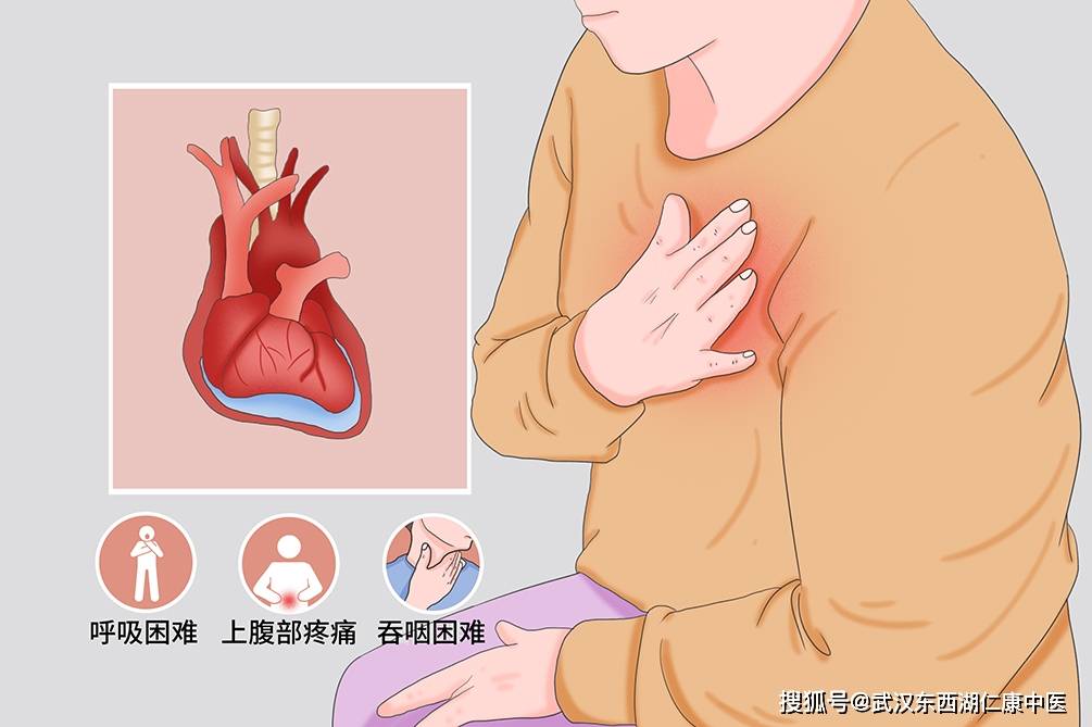 胸腔积液治疗攻略 科学方法助你轻松摆脱困扰