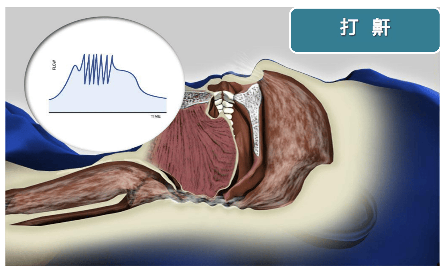 打鼾呼吸机哪个牌子好?家用呼吸机品牌排名!