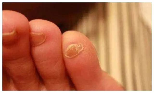 如果小脚趾有两瓣趾甲,或许不是纯正汉人,而是这个民族的后裔