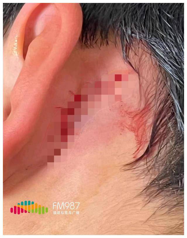 赔偿_吴女士_孩子