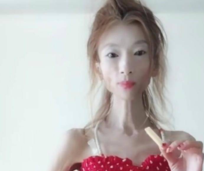 女孩为挽回男友减重70斤:压榨身体变成"骷髅妹",如今已后悔