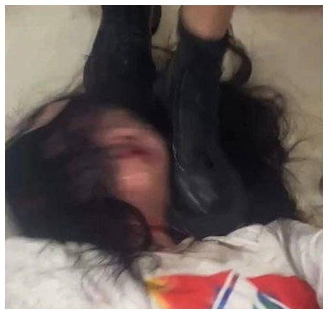 揪心!长沙女生遭霸凌后割喉,现场画面曝光,打人者发朋友圈炫耀