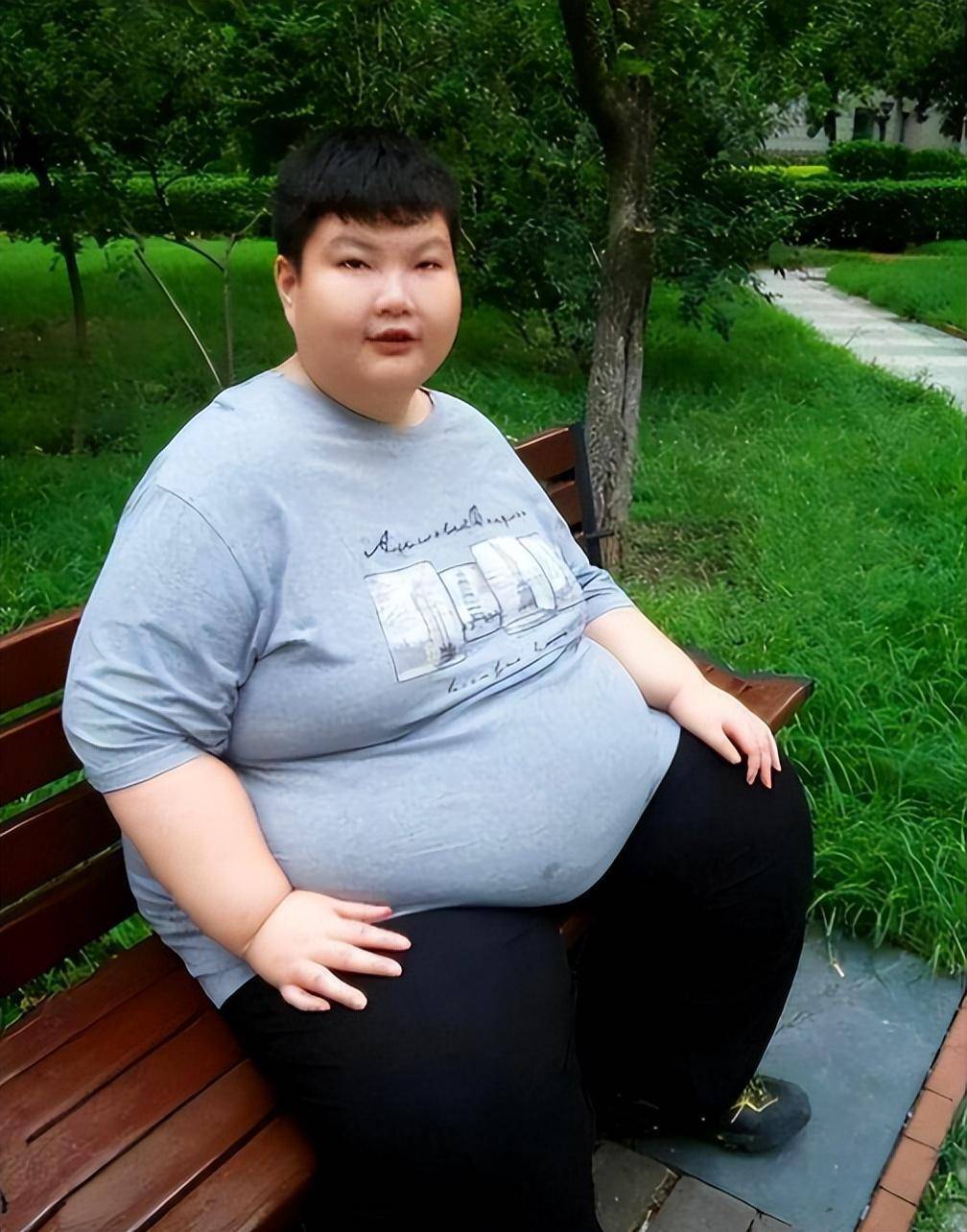 回顾:那个6秒吞下一碗粉,14岁300斤的男孩,如今怎样了