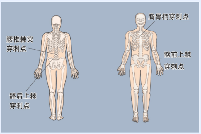 胸骨穿刺点 胸骨柄