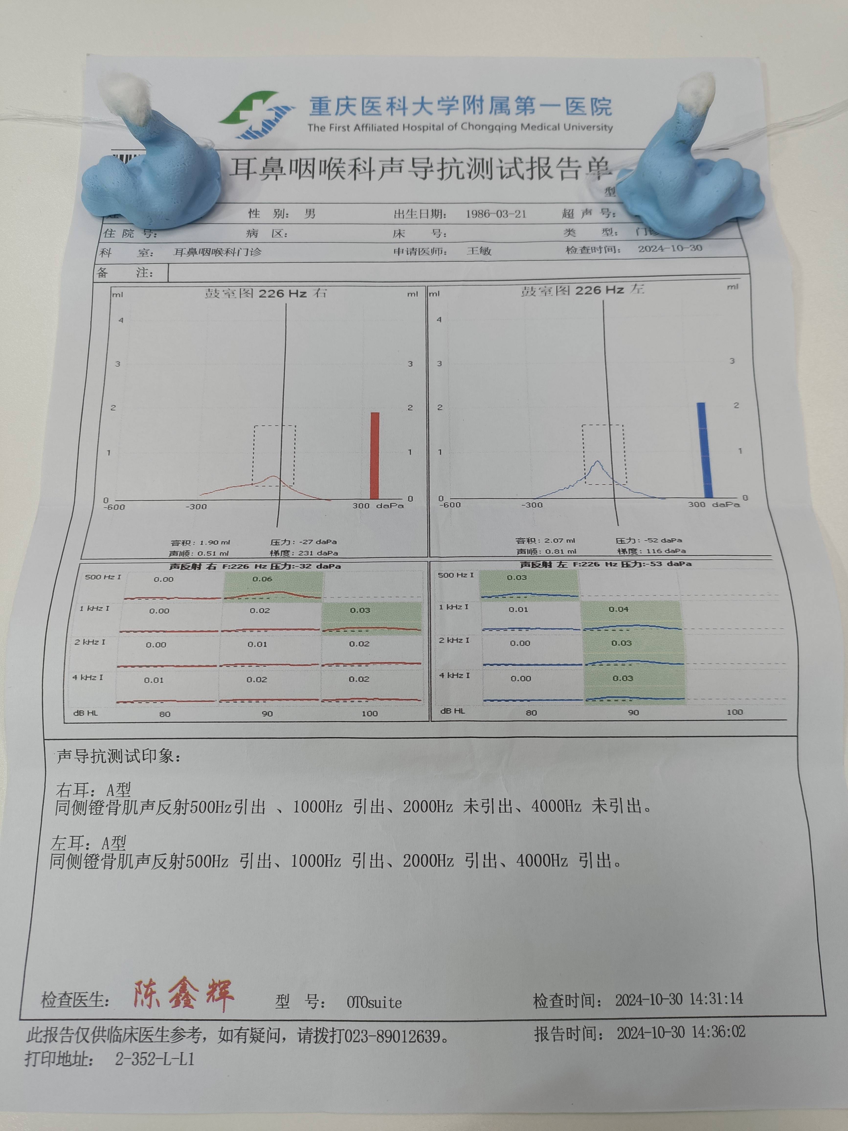 看了一下,检查报告还是比较完善的,有纯音测听,声导抗,耳声发射,听觉