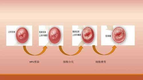 生过孩子的宫颈口图片