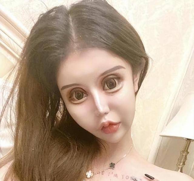 网红16岁开始整容,耗费400多万,整容200多次,最后沦落到坐轮椅