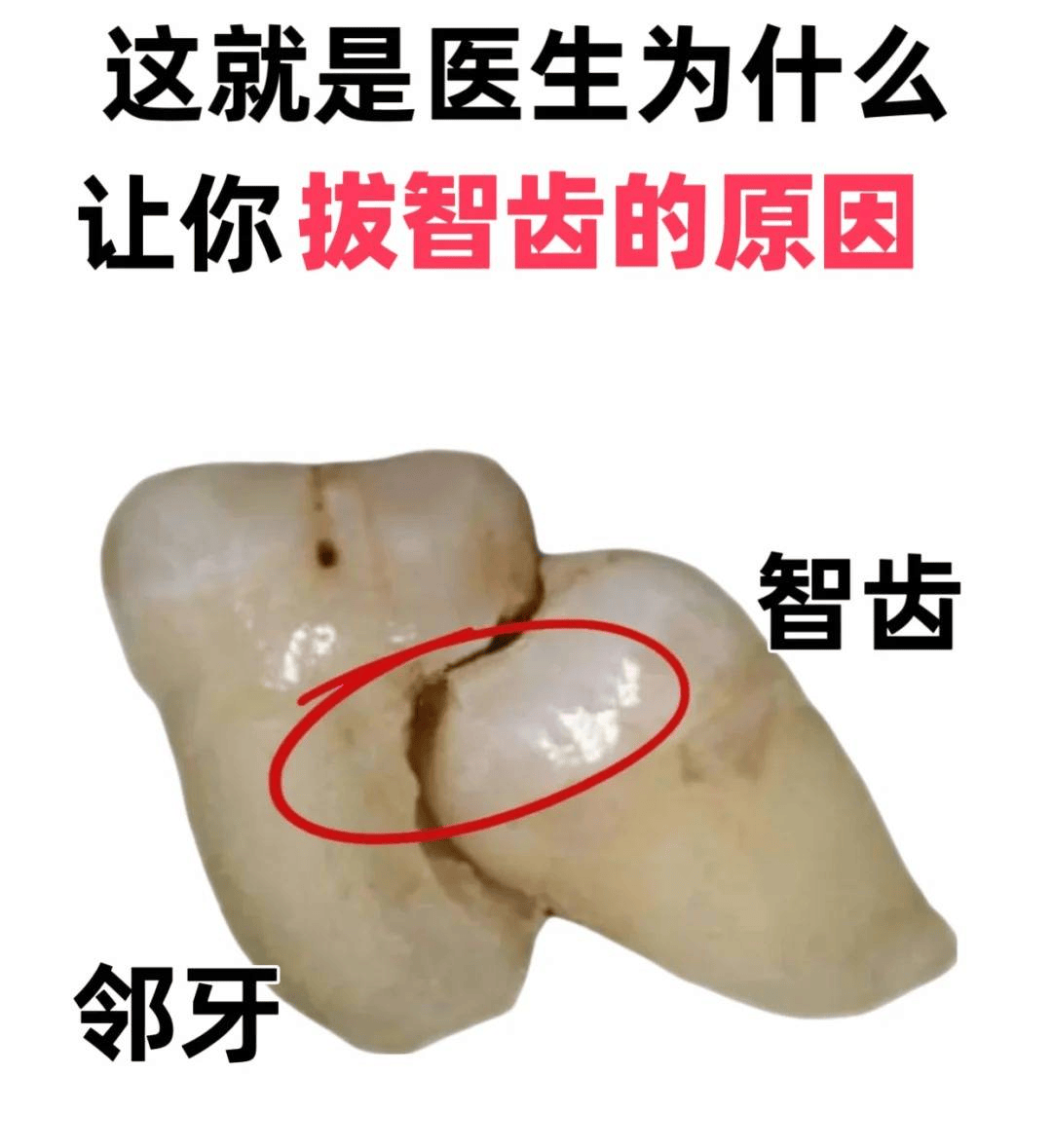 智齿长歪的图片图片