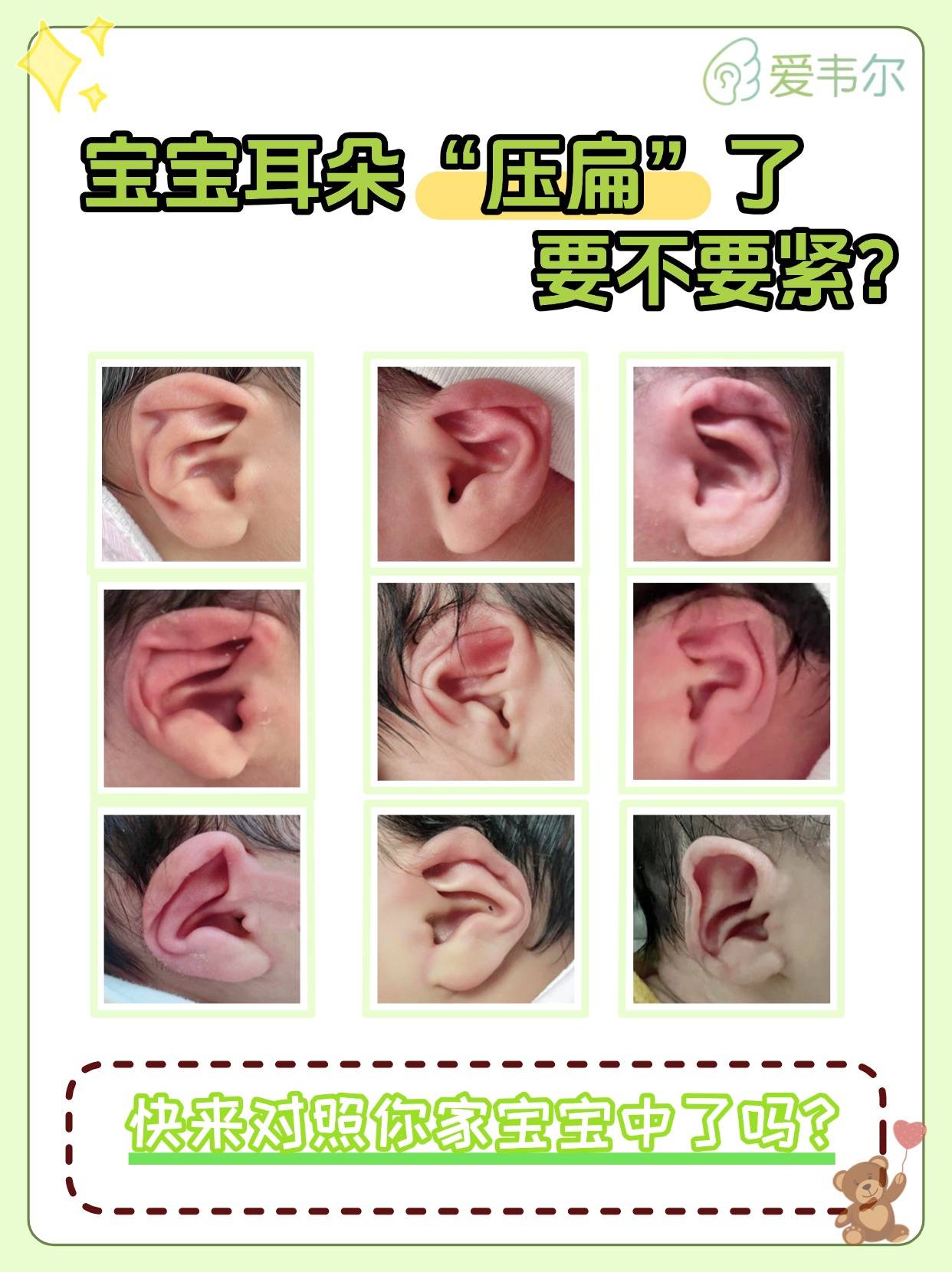宝宝耳朵压扁了怎么办