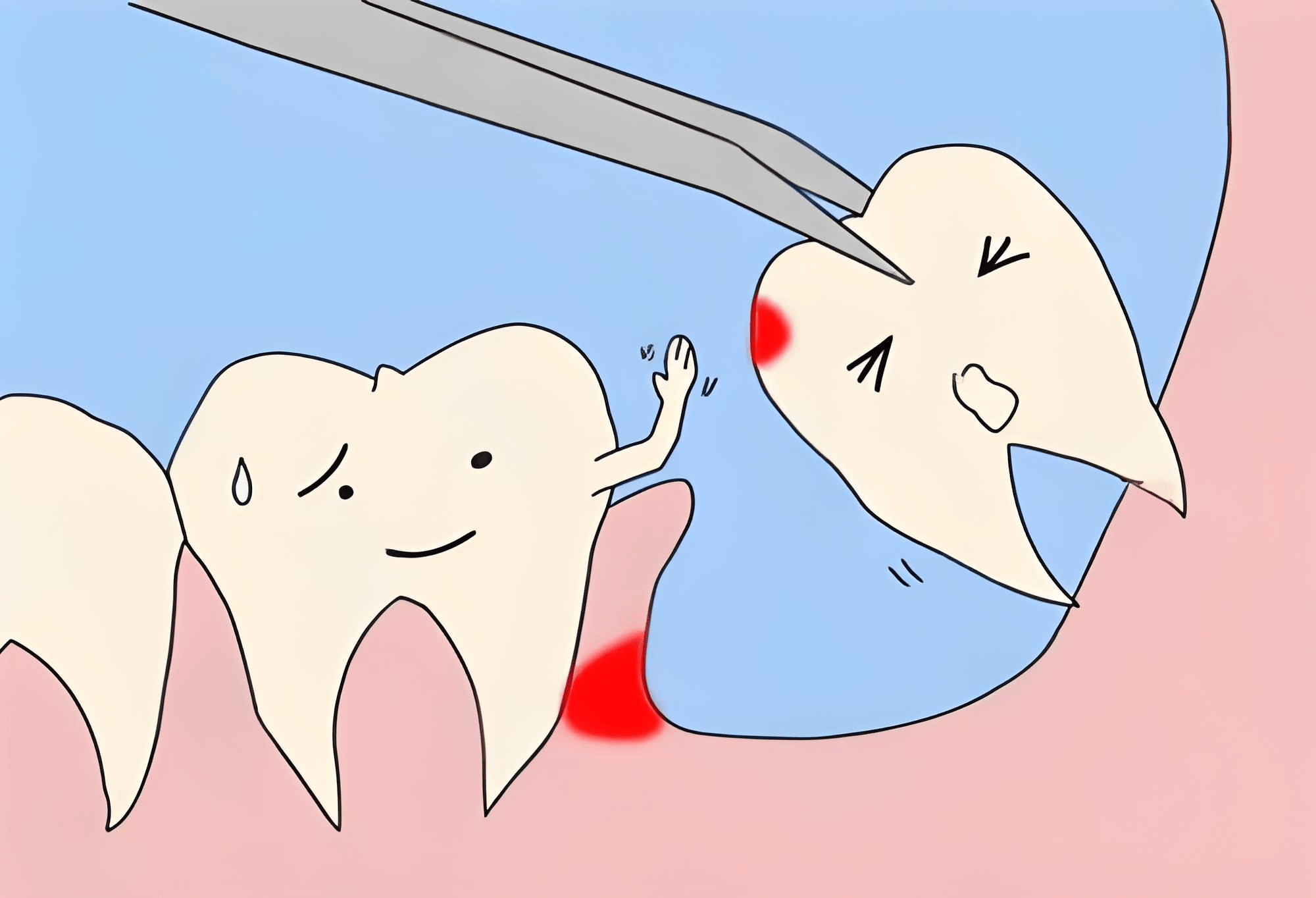 口腔科普丨智齿不疼需要拔吗?