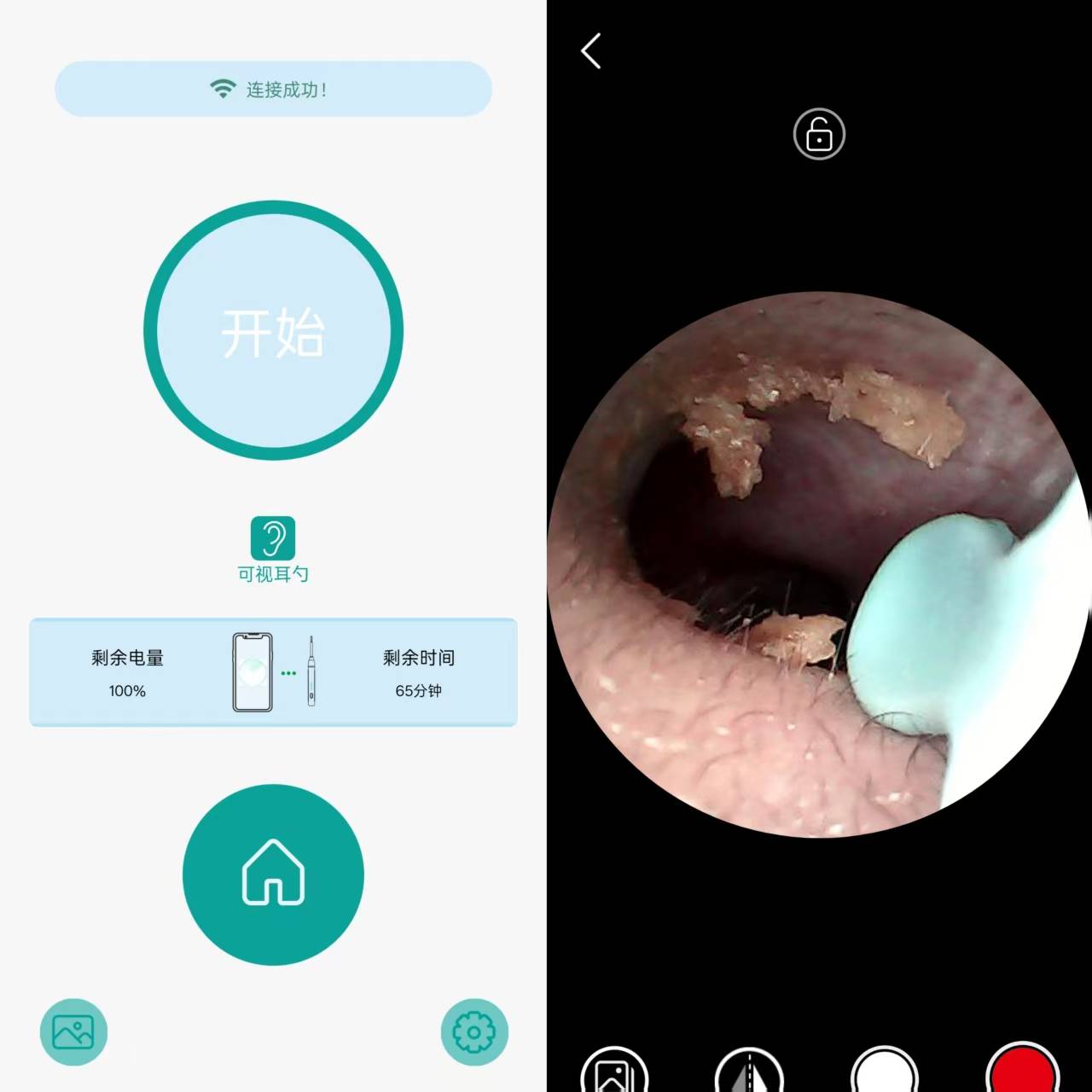掏耳朵也能玩出黑科技?西圣Find X让我重新定义"耳道清洁"!