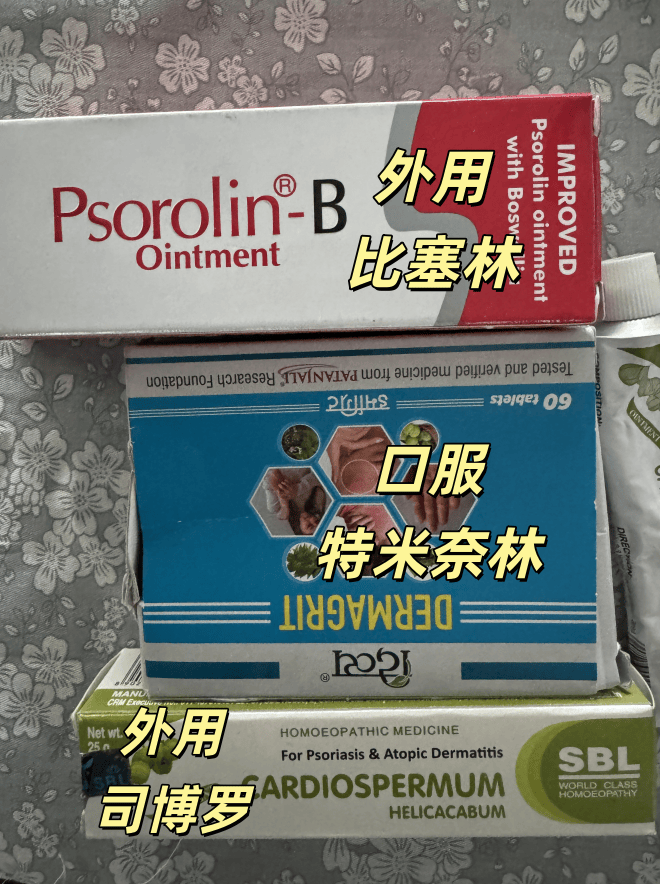 湿疹难治还是易治？内服外用调理法能否奏效？治好全靠运气？