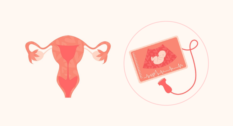 备孕攻略-什么样的子宫内膜更容易怀孕？