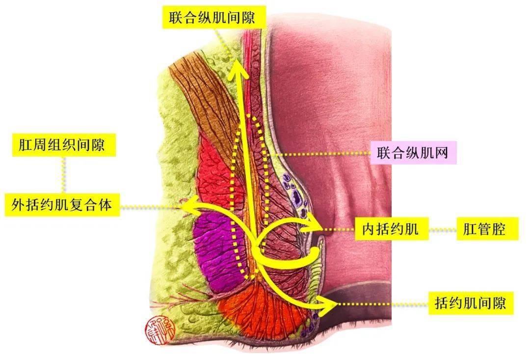 醫學乾貨|對於當下肛瘻分類方法的幾點思考!_手術